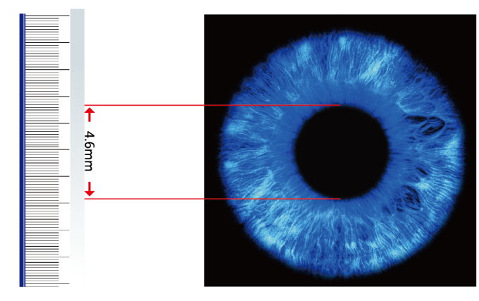 pupil